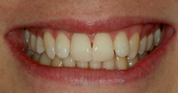 Cosmetic Dentistry
