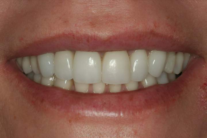 Cosmetic Dentistry Melbourne