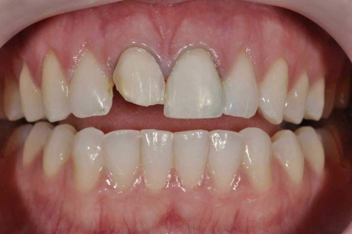 E-Max Melbourne - Processing