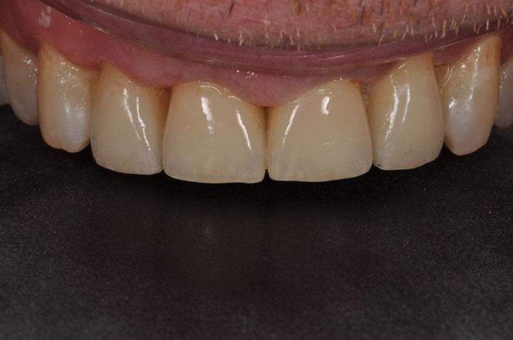 PFM Melbourne - Before