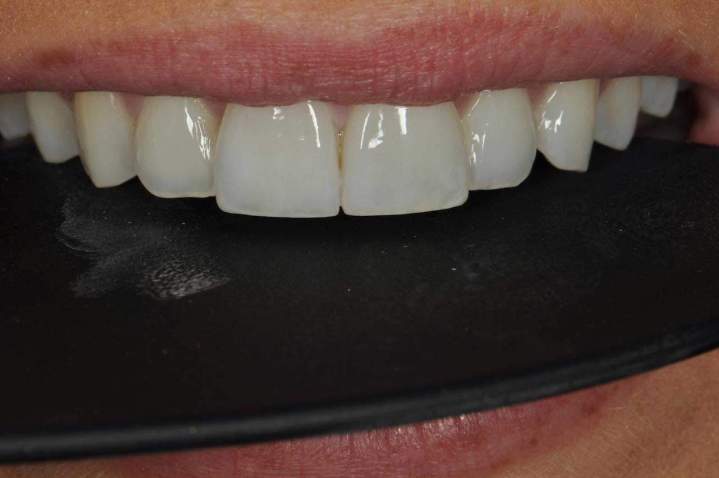 E-Max Melbourne - After