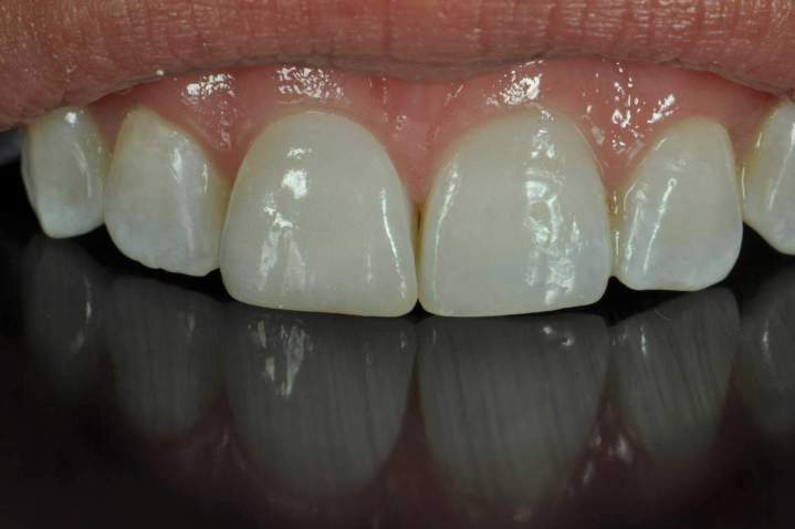 E-Max Melbourne - After