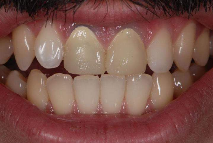 E-Max Melbourne - Processing