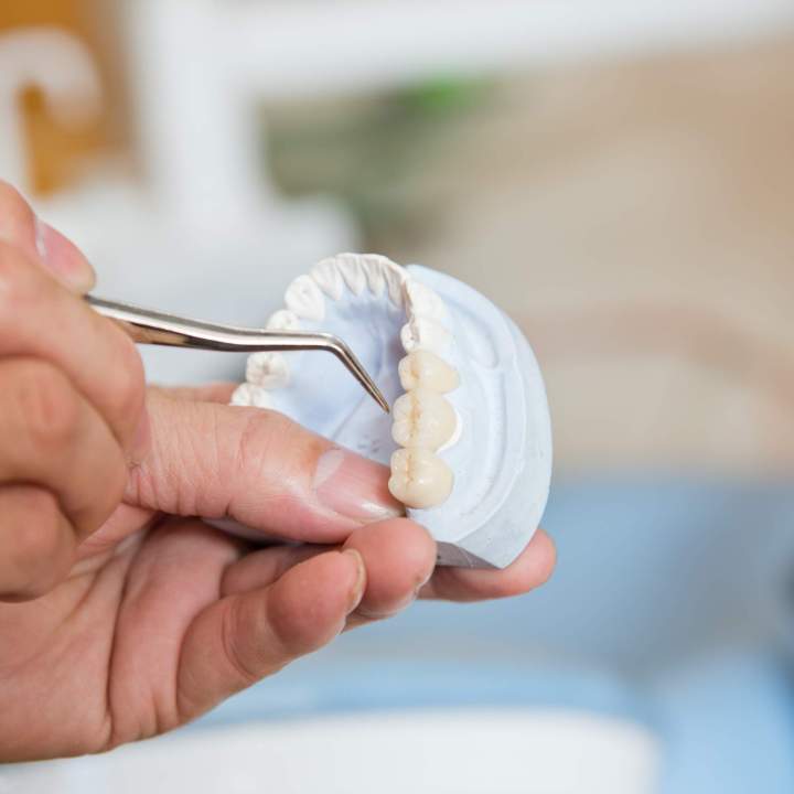 Can Dental Labs Repair Broken Dentures?<br/>Is It Possible for Dental Labs to Fix Broken Dentures?<br/>Can a Dental Lab Restore Damaged or Broken Dentures?