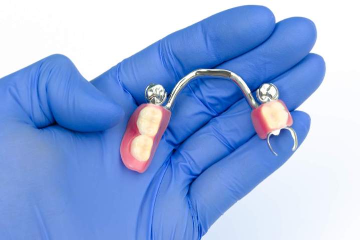 How Do I Know If I Need a Ceramic Crown?<br/>What Are the Signs That I Might Need a Ceramic Crown?<br/>What Symptoms Suggest That I May Need a Ceramic Crown?