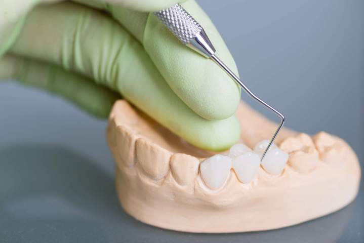 What Should I Look for in a Quality Dental Lab?<br/>What Factors Indicate a High-Quality Dental Lab?<br/>How Can I Identify a Reliable and Skilled Dental Lab?