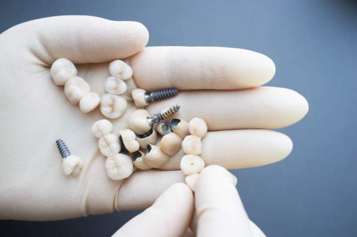 Do Dental Labs Work with Specific Types of Dentists?<br/>Do Dental Laboratories Collaborate with Certain Types of Dentists?<br/>Do Dental Labs Specialize in Working with Certain Dentists?